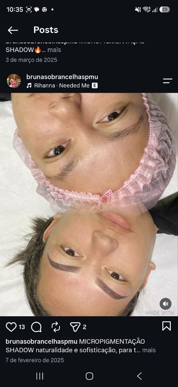 Shadow: antes e depois — resultado real do Ateliê do Olhar