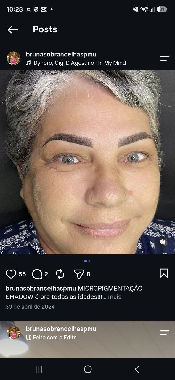Shadow em diferentes idades — resultado real do Ateliê do Olhar